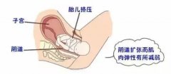 关于盆底疾病的三个事实，你应该知道